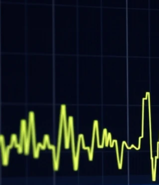 What causes GC baseline drift and baseline problems over a run?